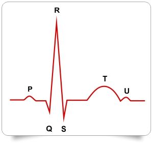 Morfología estándar teórica de un ECG PQRSTU
