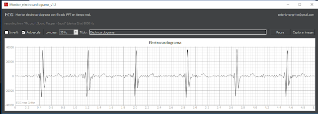 Interfaz del software en Python filtrando a 35Hz en tiempo real