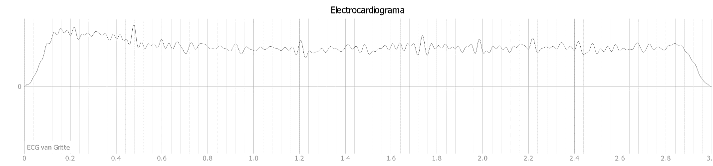 ECG en rata con todas las fuentes de ruido del quirófano activas