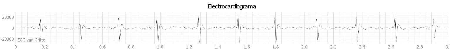 Traza electrocardiográfica en rata con filtrado a 150 Hz