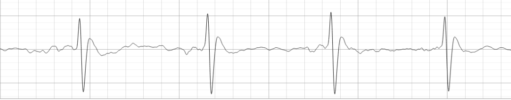Detalle ampliado de la señal ECG en rata evidenciando picos R periódicos
